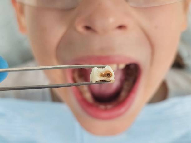 Best Dentist Open Late Near Me  in Mount Hermon, CA